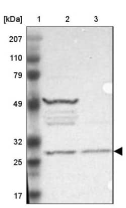 FAM109B Antibody, Novus Biologicals 25 &mu;L | Buy Online | Novus Biologicals | Fisher Scientific